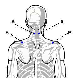акупресура