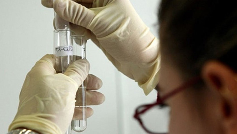 Изготвят списък на спортисти за допинг контрол