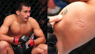 Игор Северино наказан за девет месеца заради ухапване на опонент в UFC