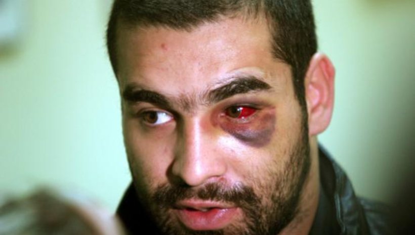 Багата излезе от реанимацията на Пирогов